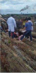 Criança é atingida por tora de madeira enquanto brincava em pátio de serraria em Mato Grosso 82 417cb411455b07f940f91024d76f3b620a8c2ce7