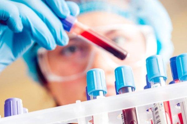 casos graves de talassemia podem ser diagnosticados nos primeiros anos de vida aponta especialista do mt saude