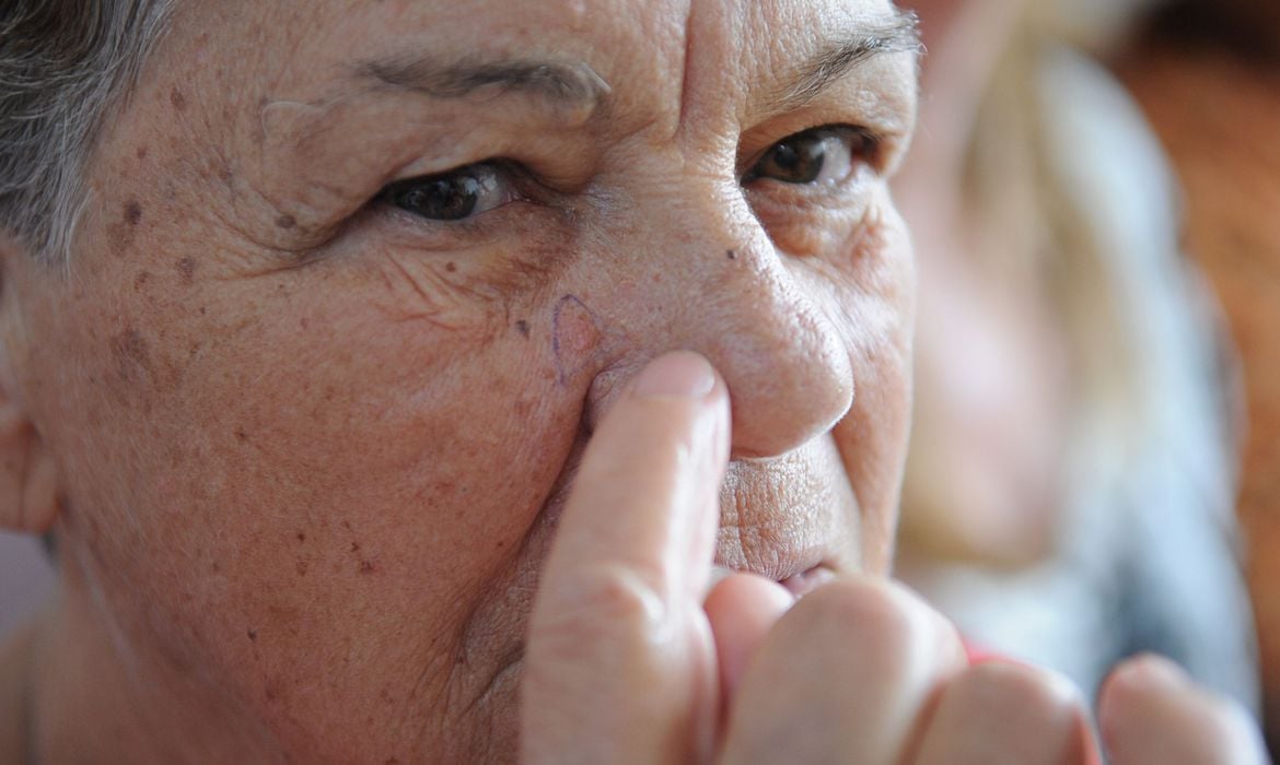 brasileiros devem redobrar cuidados no verao contra cancer de pele