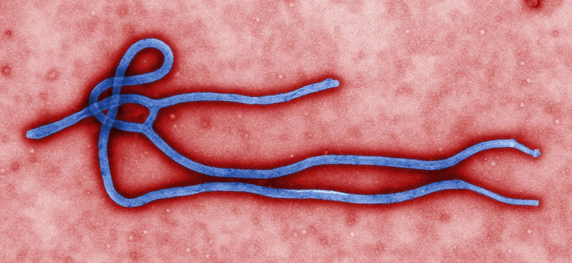 novo surto de ebola atinge a republica democratica do congo