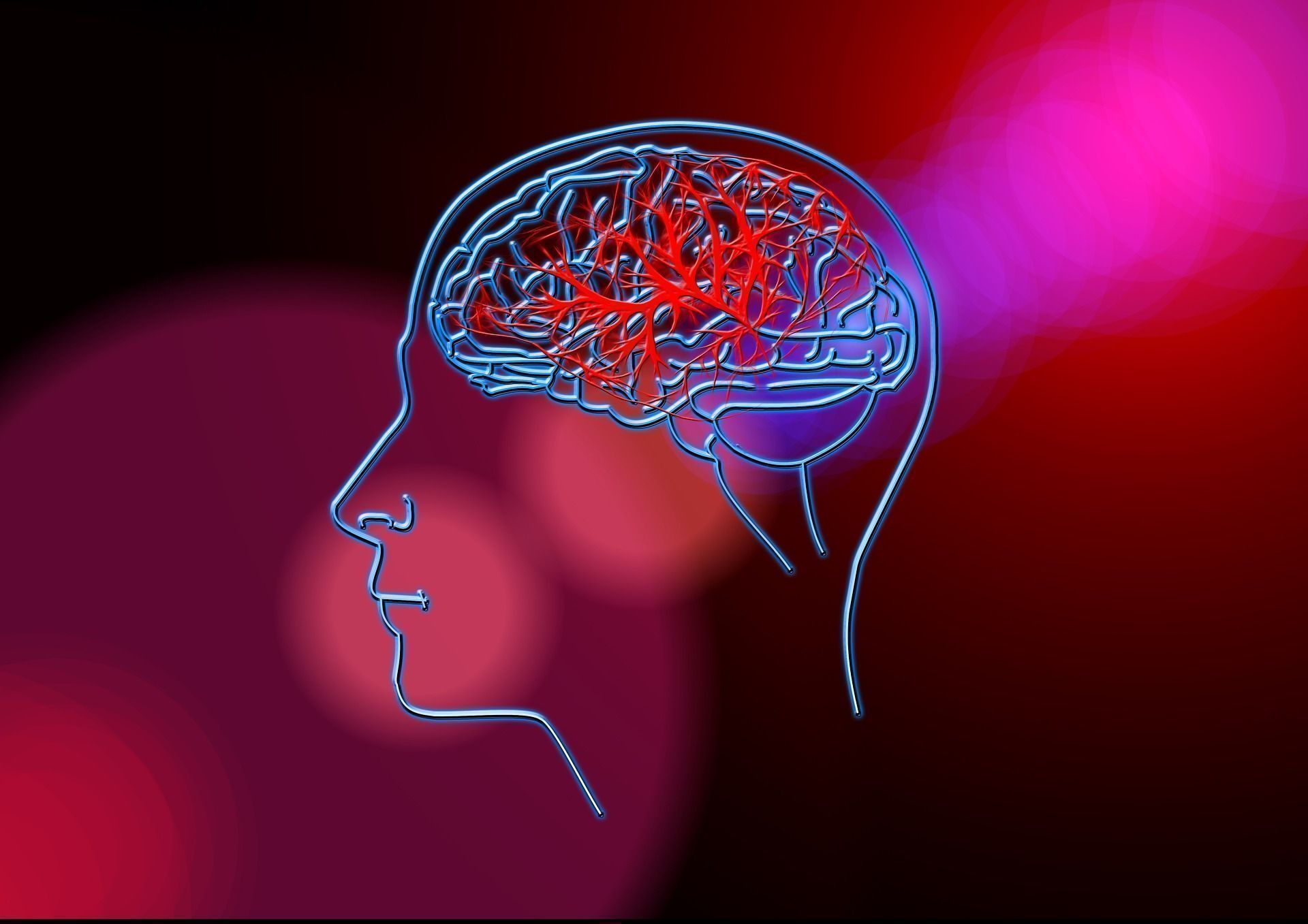 O que é um acidente vascular cerebral e o que pode causar?