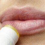 Truques para evitar herpes labial