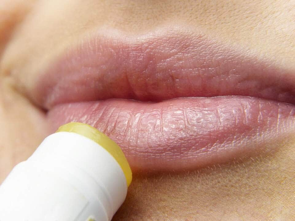 Truques para evitar herpes labial