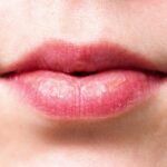 Como evitar lábios ressecados? Aprenda com essas dicas