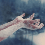 O que é a síndrome de Raynaud que causa frio e mudança de cor nos dedos
