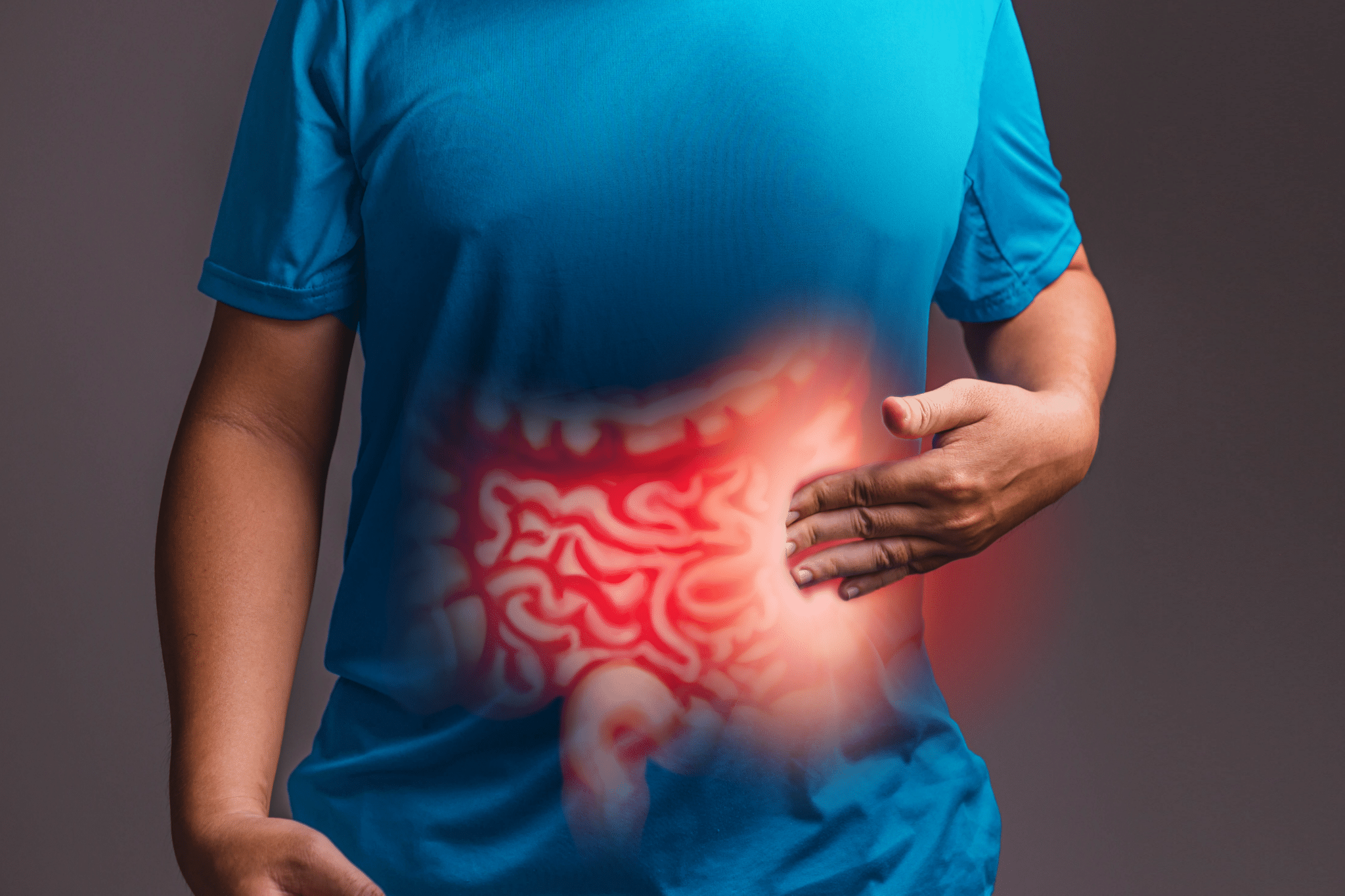 O que saber sobre a síndrome do intestino irritável?