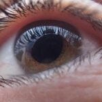 Glaucoma: como evitar a perda da visão?