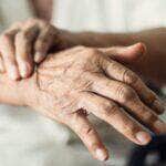 Parkinson