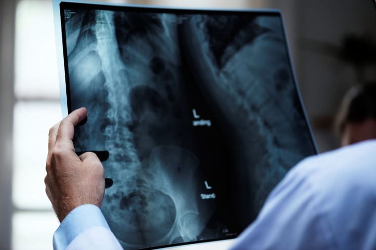 Liminar determina que empresa conserte aparelho de raios X em cidade de Mato Grosso