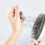 O que fazer para evitar a queda de cabelo