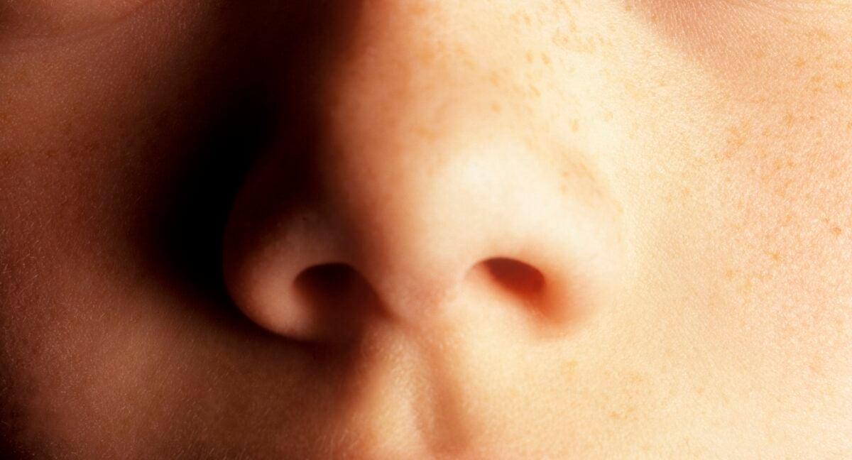 Quais são os sintomas mais comuns de câncer de nariz
