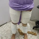 Mulheres que levavam 10 kg de cocaina enrolada no corpo sao presas em aeroporto de Mato Grosso
