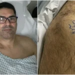 Paciente escreve 'sim' e 'não' nas pernas antes de cirurgia para marcar qual joelho deveria ser operado em Fortaleza