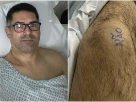 Paciente escreve 'sim' e 'não' nas pernas antes de cirurgia para marcar qual joelho deveria ser operado em Fortaleza