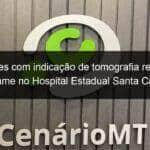 pacientes com indicacao de tomografia realizarao exame no hospital estadual santa casa 1014804