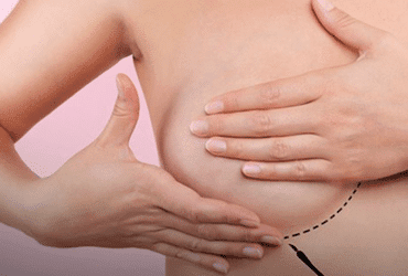Pesquisa avalia impacto da pandemia no diagnóstico e tratamento do câncer de mama - Foto: Divulgação/ Sociedade Brasileira de Mastologia