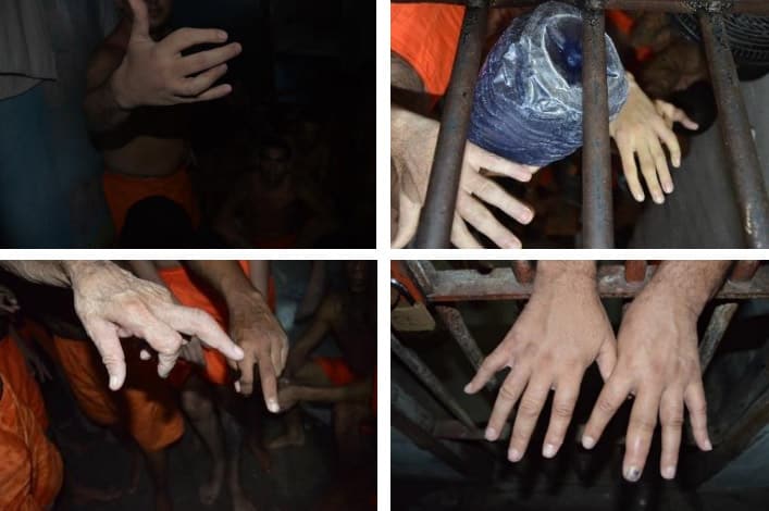 tecnica de tortura de fraturar dedos de presos e usada em 5 estados