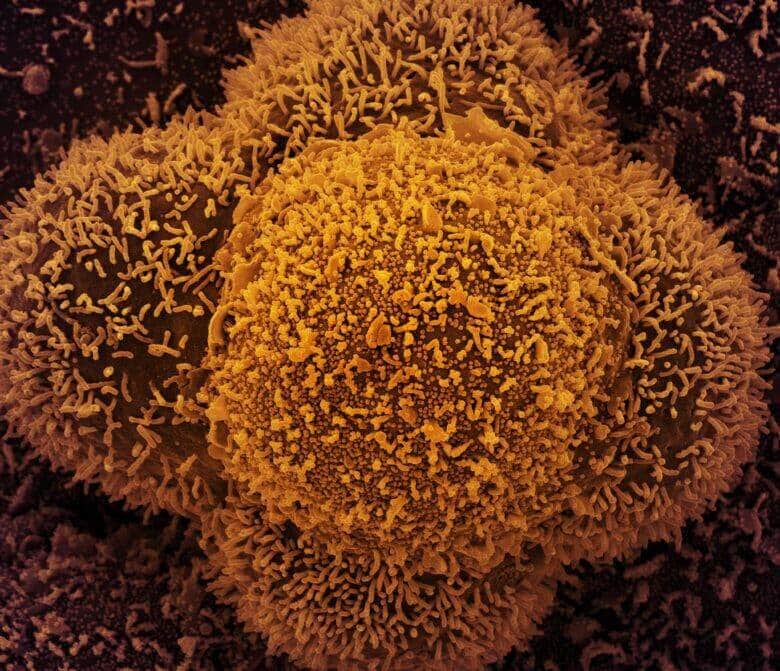 Coronavírus (COVID-19), Novo Coronavirus SARS-CoV-2 Por: NIAID