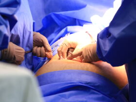 Cirurgia, varizes, operação, hospitais, UTI Por: Breno Esaki/Agência Saúde DF
