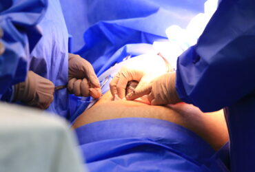 Cirurgia, varizes, operação, hospitais, UTI Por: Breno Esaki/Agência Saúde DF