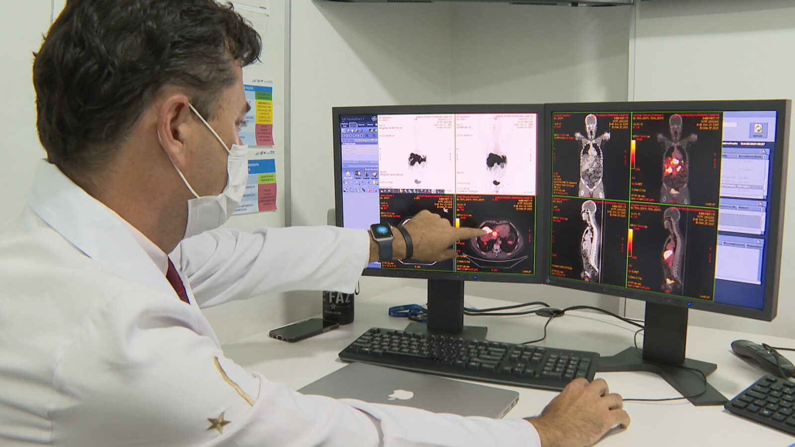Energia nuclear é usada para diagnóstico de câncer Por: Reprodução/ TV Brasil