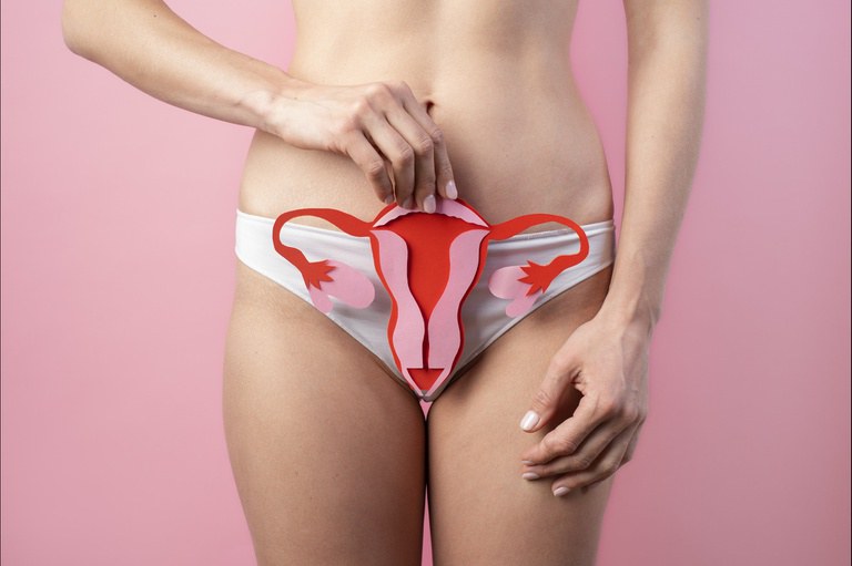 Endometriose causa cólica intensa e pode levar à infertilidade - Foto: Divulgação