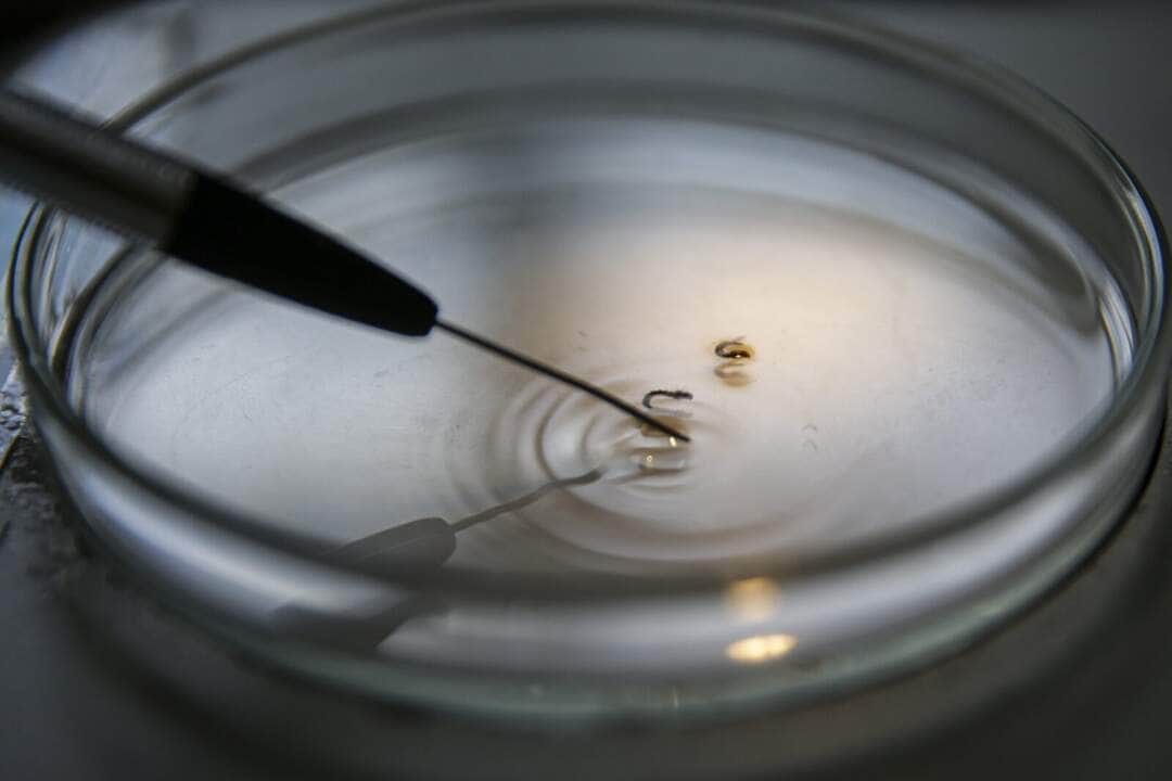 Brasília (DF), 29/02/2024 - Larvas são analisadas em laboratório da vigilância ambiental do DF para comprovação de que são do mosquito transmissor da dengue. Foto: Marcelo Camargo/Agência Brasil