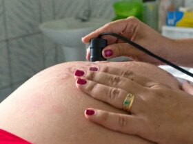 Referentes ao período de 2006 a 2015, os dados tornam o Brasil o sétimo da América do Sul no quesito taxa de gravidez adolescente Por: Arquivo/MDS