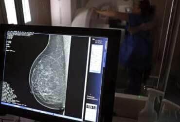 Brasília (DF), 01/10/2024 - Teste de mamografia realizado na Campanha Outubro Rosa: Sesc-DF, que oferece exames e consultas gratuitas às mulheres.  Foto: José Cruz/Agência Brasil