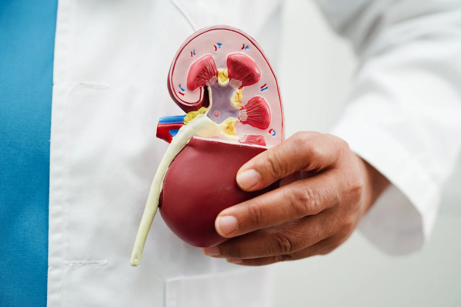 Cuidado com os rins 4 Chronic kidney disease, doctor holding model for treatment urinary system, urology, Estimated glomerular filtration rate eGFR. - Fotos do Canva1