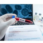 Mpox registra aumento de 225% em Mato Grosso