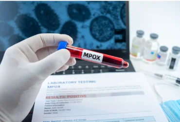 Mpox registra aumento de 225% em Mato Grosso