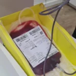 Hemocentro atende mais de 500 pacientes com doença falciforme