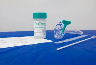 Novo teste de HPV pelo SUS promete rastrear câncer do colo do útero precocemente