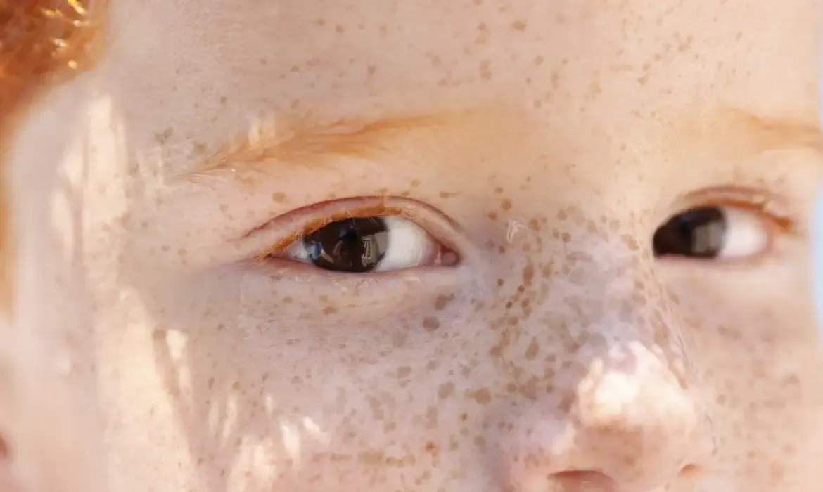 Reflexo branco nos olhos: entenda os riscos da leucocoria em bebês