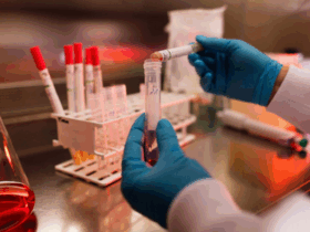 Coordenadora do Serviço de Atendimento Especializado (SAE), doutora Gabriela Porazzi, reforça a importância da testagem anual e do uso de preservativos para conter o avanço da infecção no município