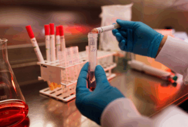 Laboratorio alvo de operacao policial fraudava exames de HIV sifilis e hepatite em Mato Grosso