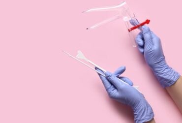 Teste de DNA HPV no SUS