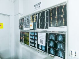 Saude de Cuiaba ja oferece mamografia e ressonancia para mulheres