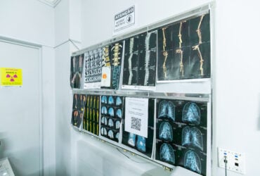 Saude de Cuiaba ja oferece mamografia e ressonancia para mulheres