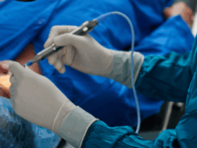 Saude de Sorriso convoca 140 pacientes para cirurgia de catarata