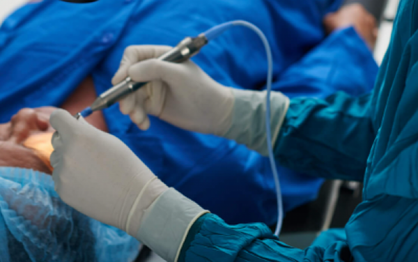 Saude de Sorriso convoca 140 pacientes para cirurgia de catarata