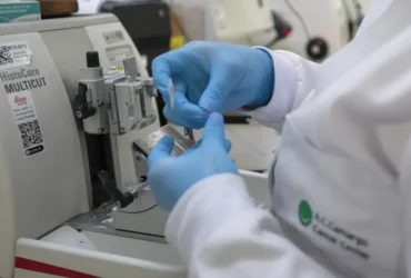 Câncer de próstata pode ter cura de até 98% no estágio inicial