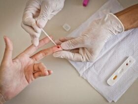 Secretaria de Saude de Mato Grosso alerta para a sifilis e reforca o diagnostico precoce contra a doenca