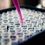 Pesquisas brasileiras avançam no diagnóstico do Alzheimer por exame de sangue