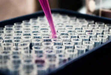 Pesquisas brasileiras avançam no diagnóstico do Alzheimer por exame de sangue