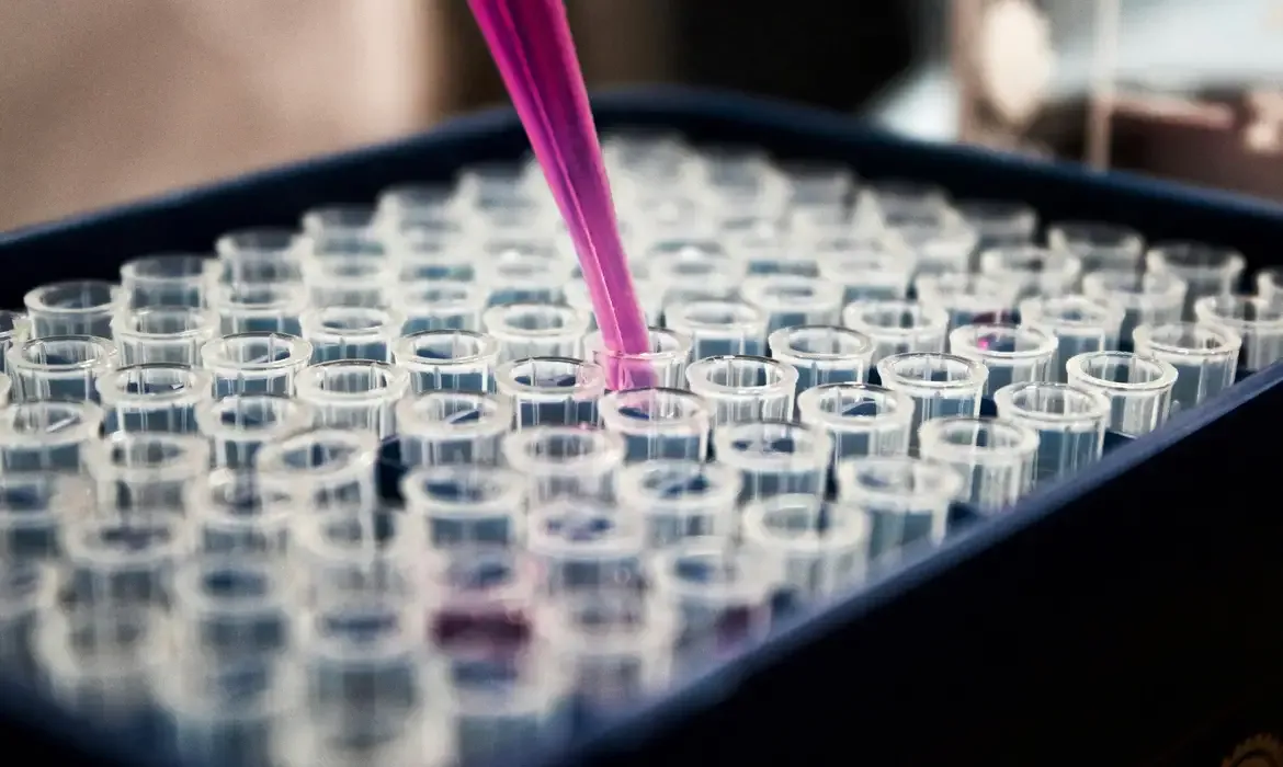 Pesquisas brasileiras avançam no diagnóstico do Alzheimer por exame de sangue