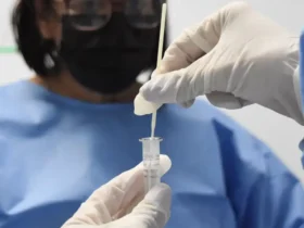 Covid-19 lidera mortes por vírus respiratórios nas últimas quatro semanas