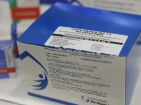 Fiocruz amplia produção de kits diagnósticos para o SUS