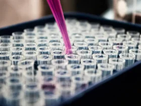 Inflamação no cérebro é apontada como chave no Alzheimer